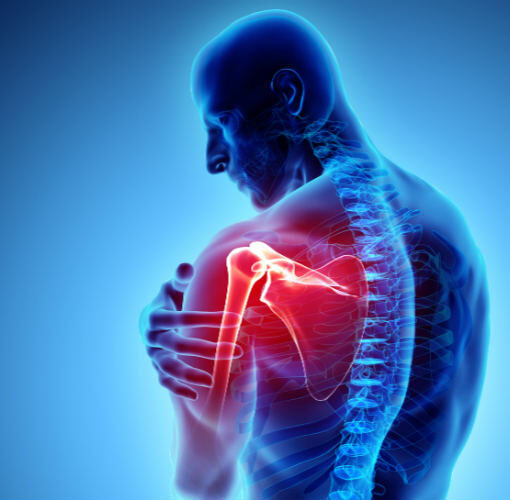 Bloqueio de dor para ombro