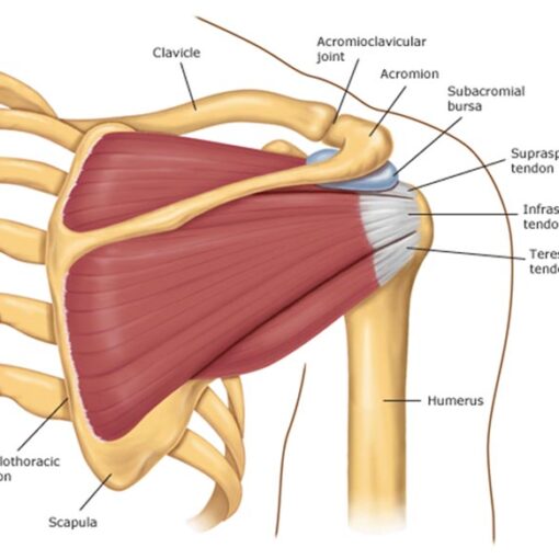 Cirurgia para manguito rotador