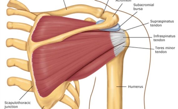 Cirurgia para manguito rotador
