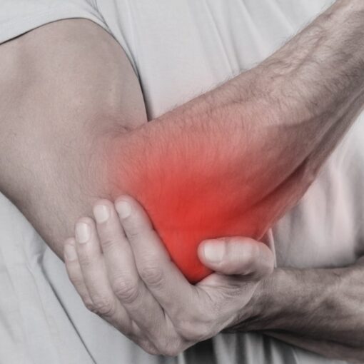 Epicondilite do cotovelo