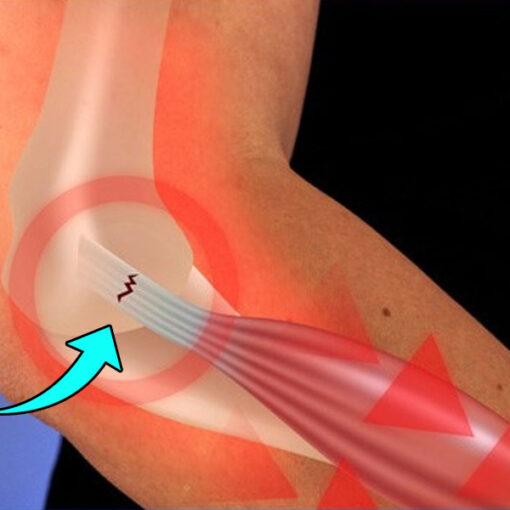 Especialista em cotovelo