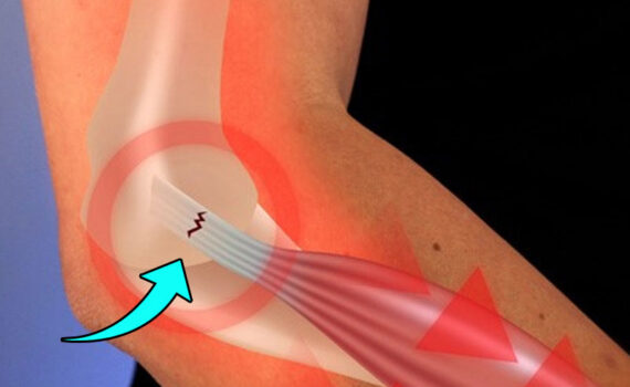 Especialista em cotovelo