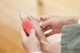 O melhor Reumatologista para tratamento de Gota