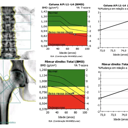 O melhor médico para tratamento de osteoporose analisando exames em consultório