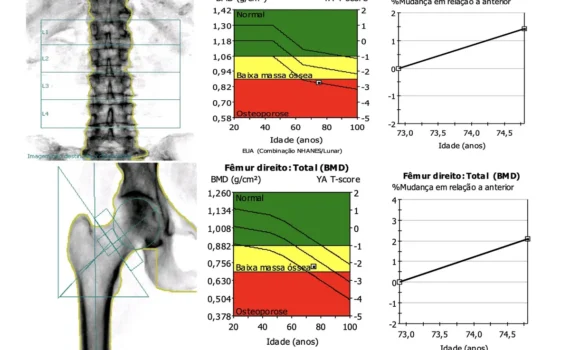 O melhor médico para tratamento de osteoporose analisando exames em consultório