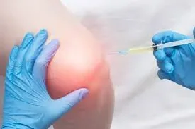 O melhor Reumatologista para tratamento de dor no joelho em atendimento clínico